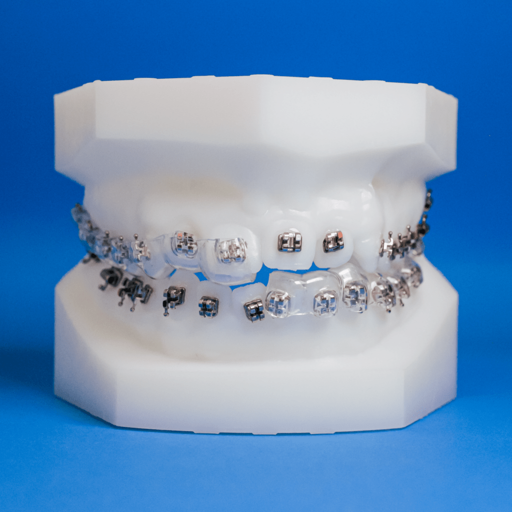 Orthodontic Appliances: Custom Lab-Fabricated Designs