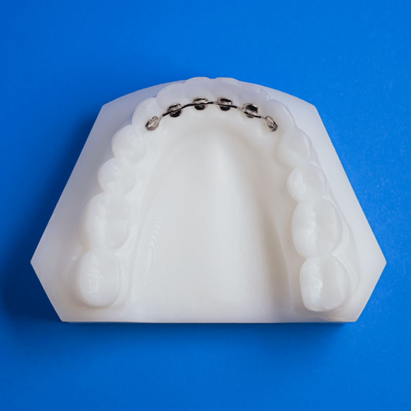 Mesh Fixed Lingual Retainers - Specialty Appliances