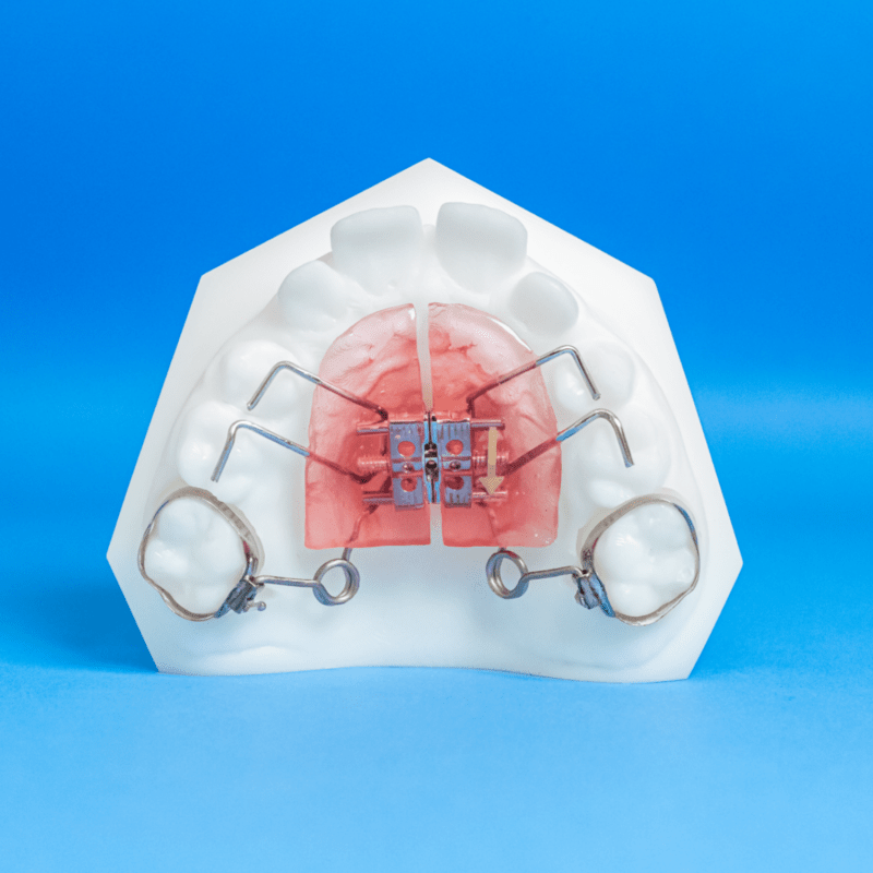 Pendex - Specialty Appliances