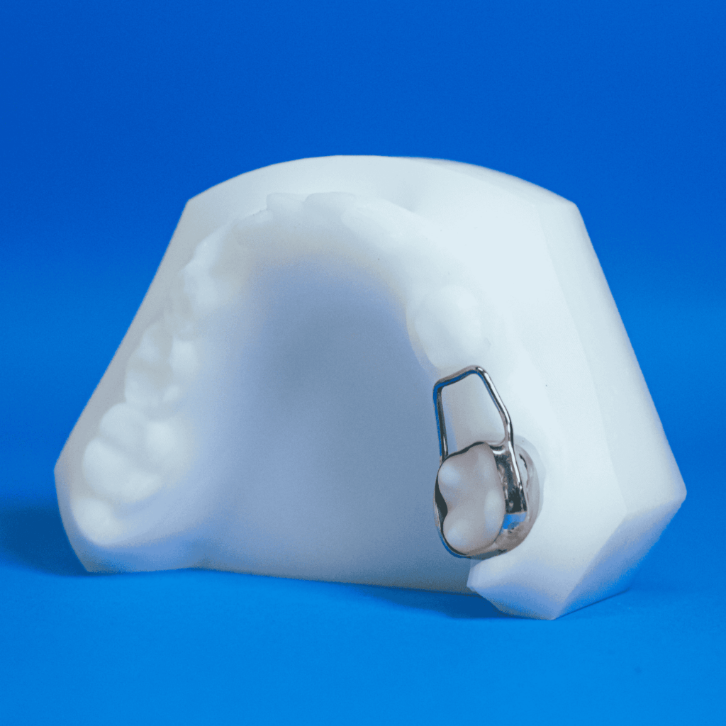 Space Maintainer - Specialty Appliances