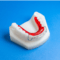 Super Modified Spring Retainer: Anterior Alignment Appliance