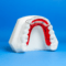 Super Modified Spring Retainer: Anterior Alignment Appliance