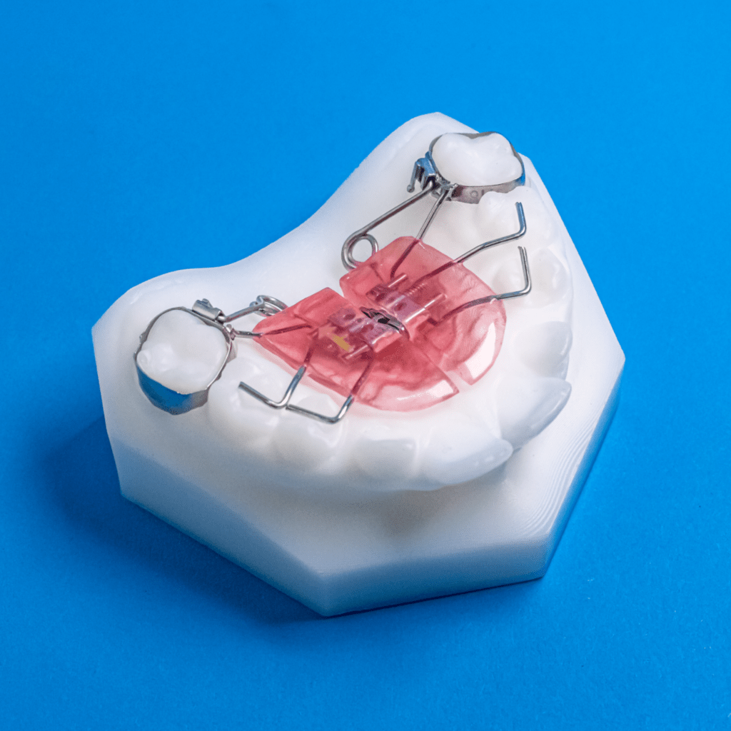 TRex Specialty Appliances