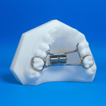 Upper RPE - Specialty Appliances
