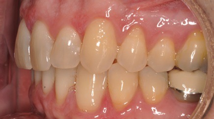 iFinisher after Specialty Appliances