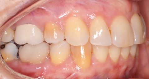 IFinisher after Specialty Appliances