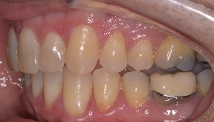 iFinisher before - Specialty Appliances