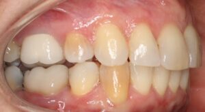 iFinisher Before Specialty Appliances