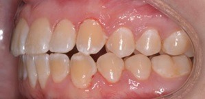 iFinisher Before Specialty Appliances