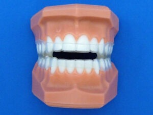 Damon Splint Specialty Appliances