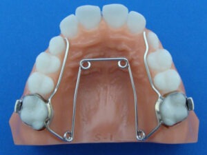 Fixed Quad Helix Specialty Appliances