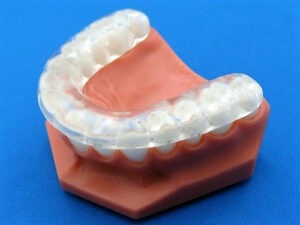 Flat Plane Splint Specialty Appliances