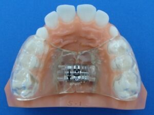 BRPE Full Palate Specialty Appliances