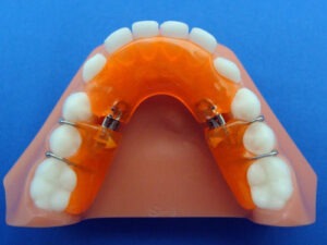 Sagittal Specialty Appliances