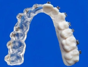 standard indirect bonding Specialty Appliances