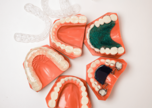 Specialty Appliances Orthodontic Lab