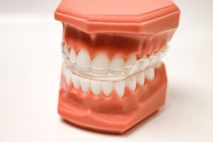 Specialty Appliances Orthodontic Lab