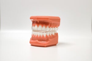 Specialty Appliances Orthodontic Lab