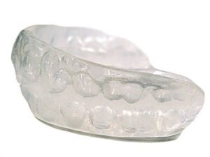 Specialty Appliances Orthodontic Lab