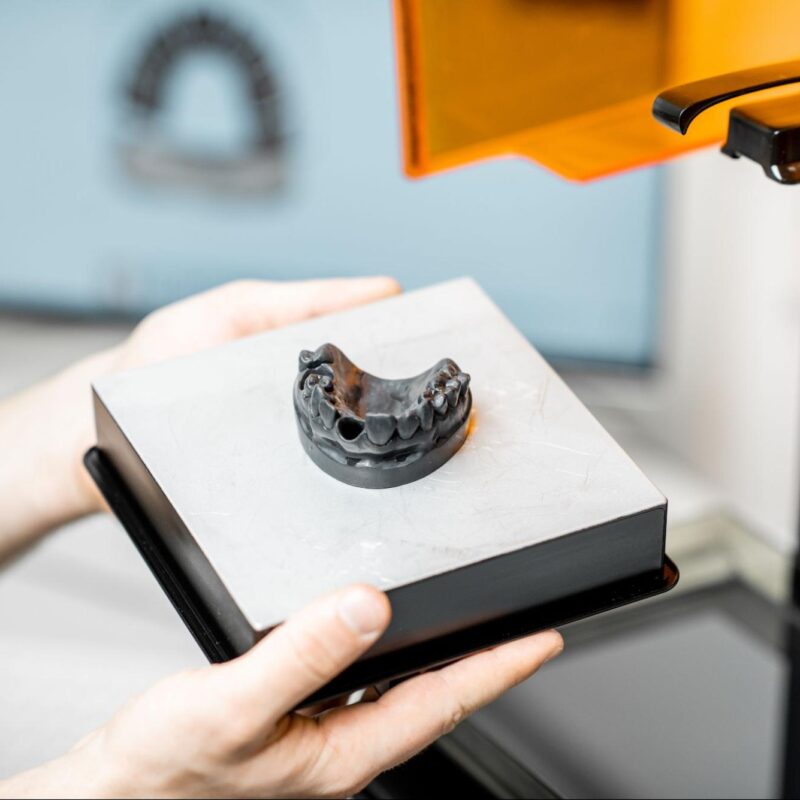 3D Printing: The Future of Orthodontics