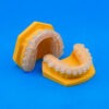 Printed 3D Indirect Bonding - Image 2
